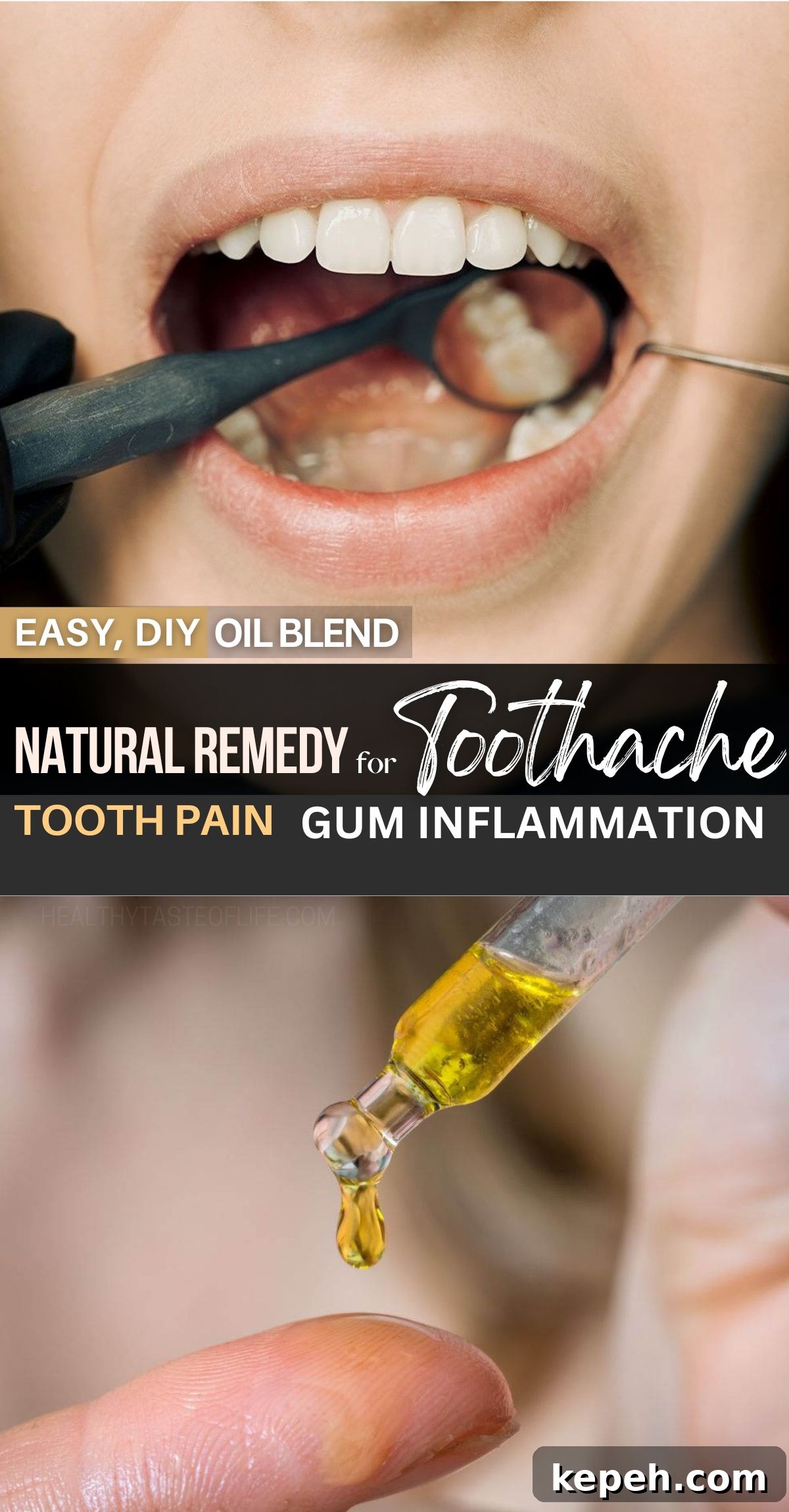 DIY Aromatherapy Oil Blend for Toothache and Pain Relief 14 This blend of oils for toothache is a great all-natural home remedy to relieve dental pain and gum inflammation.