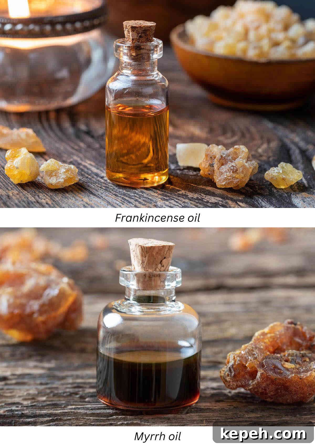 DIY Aromatherapy Oil Blend for Toothache and Pain Relief 8 Frankincense oil and myrrh oil for toothache pain inflammation.